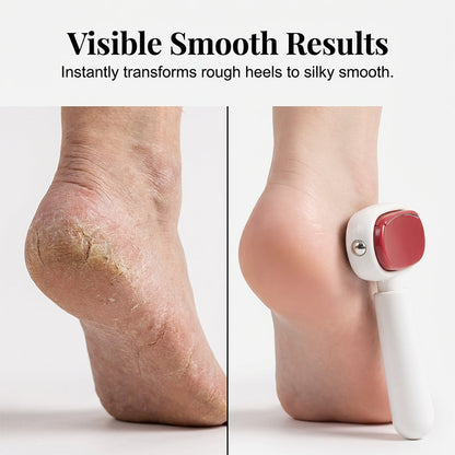 ⏳ FINAL 24 HOURS · 50% OFF🦶Double-Sided Foot Scraper for Smooth Heels